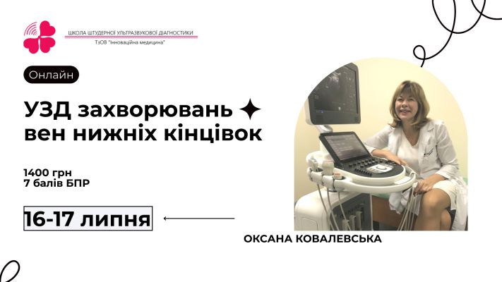 УЗД захворювань вен нижніх кінцівок